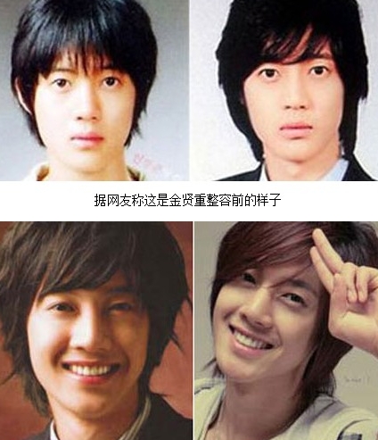 金贤重整容了吗+金贤重承认整容前后对比评价图